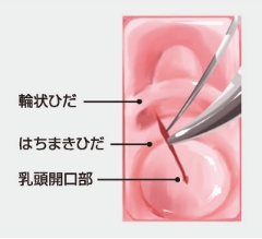 輪状ひだ、はちまきひだ、乳頭開口部のイラスト
